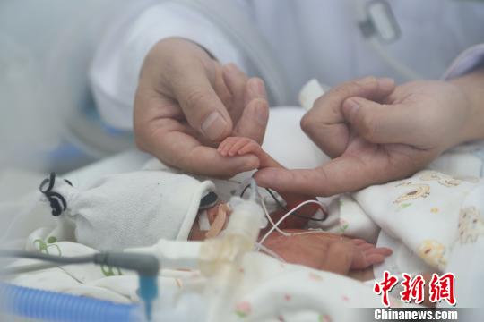 一名胎齡僅26周嬰兒從湖北恩施空中轉運武漢 一名胎齡僅26周嬰兒從湖北恩施空中轉運武漢