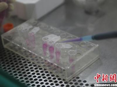 中國科學(xué)家首創(chuàng)I型糖尿病全新治療性DNA疫苗