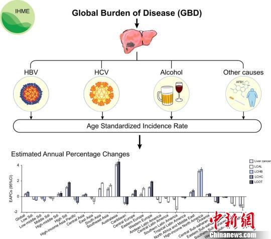 中國學(xué)者率先系統(tǒng)解析全球不同地區(qū)肝癌發(fā)病模式 中國學(xué)者率先系統(tǒng)解析全球不同地區(qū)肝癌發(fā)病模式