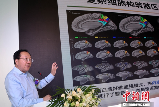 中科院自動化所腦科研成果“落地” 研發出先進腦氧檢測設備-易網健康養生網 中科院自動化所腦科研成果“落地” 研發出先進腦氧檢測設備