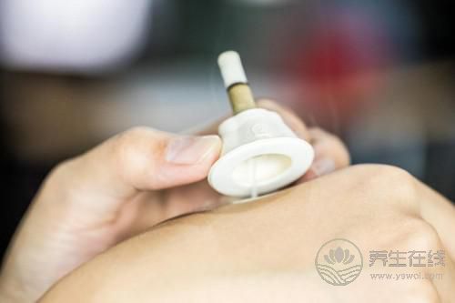 艾艾貼艾灸器：知名養生節目都在講它，連《向往的生活》里都有它