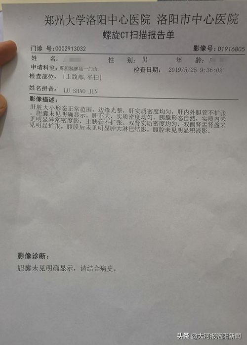 13年前只在洛陽市商業(yè)職工醫(yī)院做過一次闌尾手術 為何膽囊不見了？