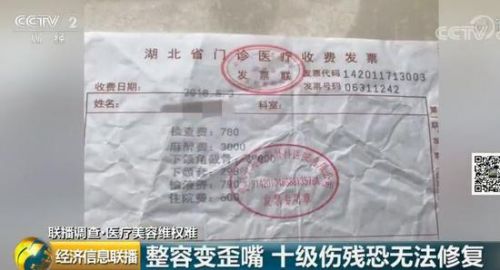 女子花3.5萬在武漢華美整形外科醫院整形致殘 院方只賠5000塊了事