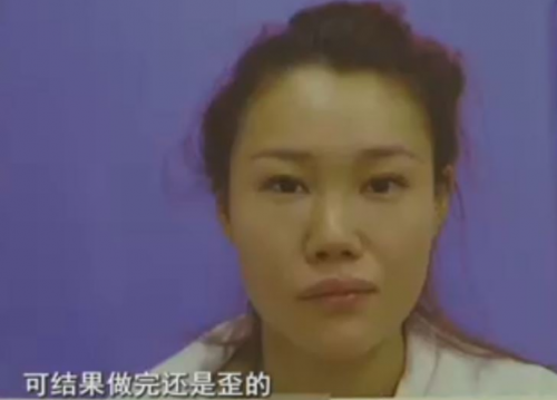 杭州格萊美整形醫院把美女鼻子成了S型 只敢開美顏拍照-易網健康<a href=http://m.aoa7937.com/jkys/ target=_blank class=infotextkey>養生</a>網 杭州格萊美整形醫院把美女鼻子成了S型 只敢開美顏拍照