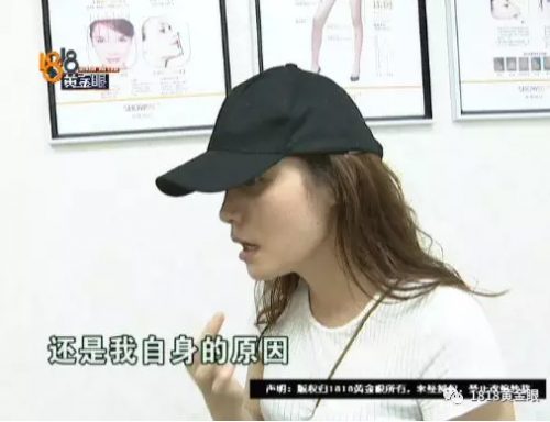女子花4萬多在寧波首美整形美容醫院做鼻子 術后鼻子卻像被人打過