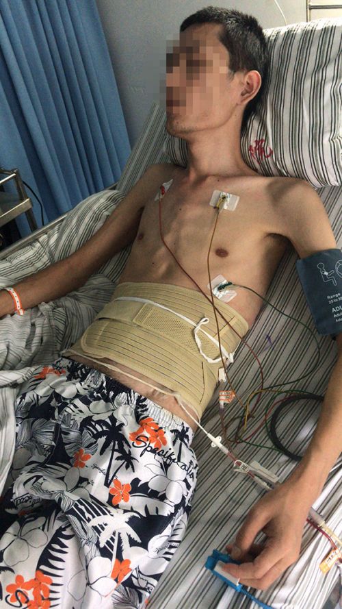 患者注射阿達木單抗注射液后感染肺結核 醫院:治療欠規范愿擔責三成