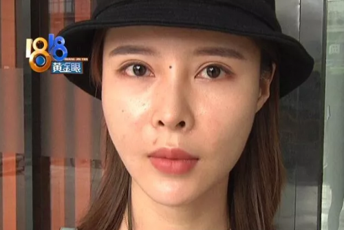 杭州麗星整形醫(yī)院整壞了鼻子至妍醫(yī)療美容來(lái)修復(fù) 醫(yī)院更名了？