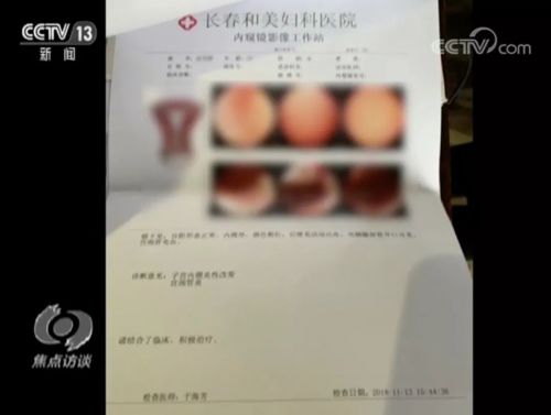 長春和美婦科醫(yī)院怎么樣？已被不少患者投訴 焦點訪談曝光后現(xiàn)已停業(yè)