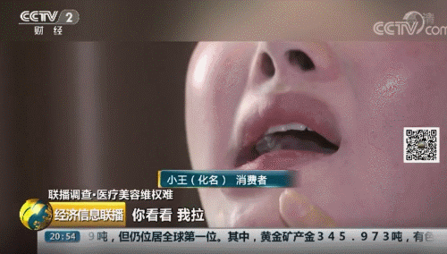 女子花3.5萬在武漢華美整形外科醫院整形致殘 院方只賠5000塊了事