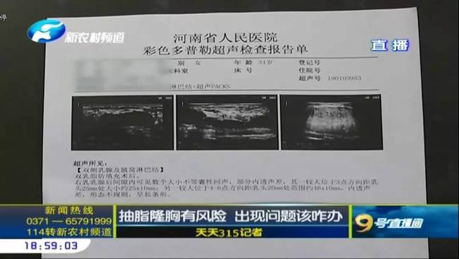 鄭州曹樂醫療整形：抽脂隆胸不靠譜 整出問題溝通難