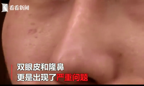貴陽聚星妍美整形醫(yī)院怎么樣？女子做4項整形都失敗 還遭言語羞辱