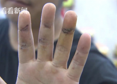 通州灣三余人民醫(yī)院為男病人配婦科用藥？院方：拿錯了