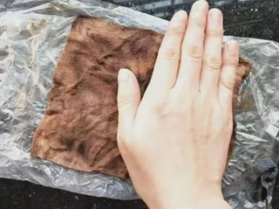 福建一女子順產，紗布留體內30天！建陽第一醫院：不算罕見