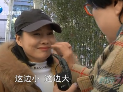 整形有風險！女子在鄭州東方整形醫院手術后臉一邊大一邊小