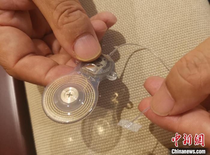 “國產人工聽覺腦干植入系統” 成果轉化簽約 擺脫進口依賴-易網<a href=http://m.aoa7937.com/ target=_blank class=infotextkey>健康養生</a>網 “國產人工聽覺腦干植入系統” 成果轉化簽約 擺脫進口依賴