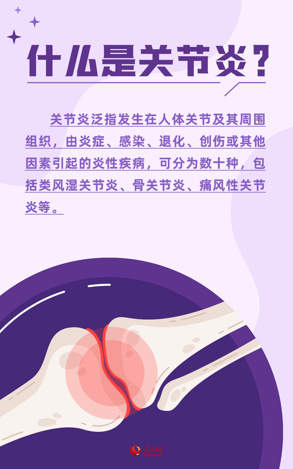 世界關節炎日：警惕！關節最怕這5件事兒