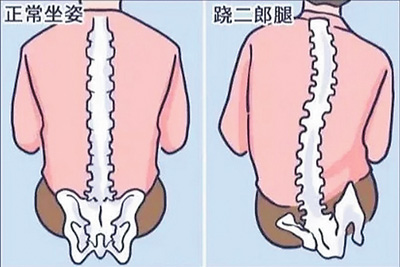 不良體態正悄悄損害你的健康(服務窗)-易網<a href=http://m.aoa7937.com/ target=_blank class=infotextkey>健康養生</a>網 不良體態正悄悄損害你的健康(服務窗)