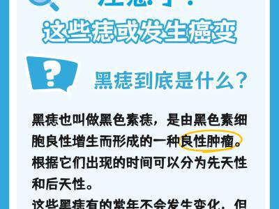 身上有痣的人注意了！這些痣可能會發(fā)生癌變