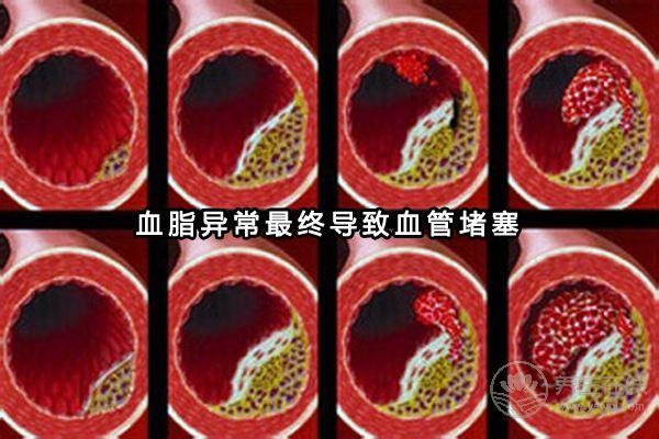 患高血脂人群越來越多，多吃這6種食物可以有效預防