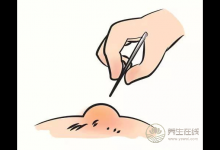 燙傷了怎么辦？6個處理誤區，還有很多人用