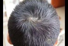 早生華發(fā)，試試枸杞，能幫你找回黑發(fā)