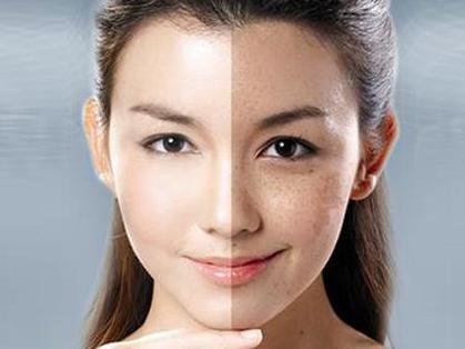 臉上長斑要怎樣可以去除臉上的斑點(diǎn)