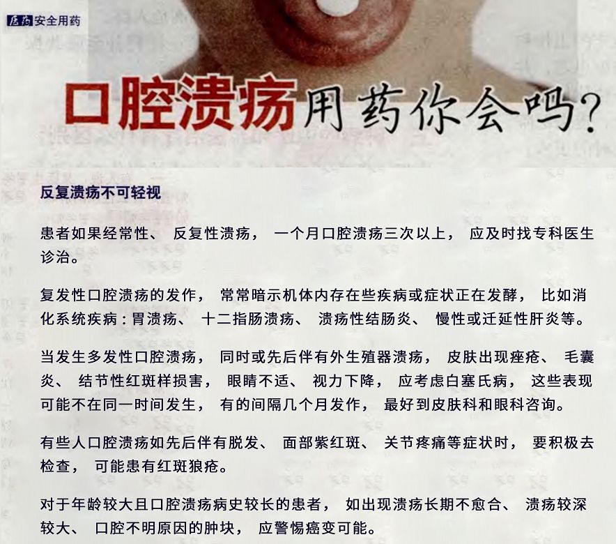 口腔潰瘍疼到崩潰?用它10秒止痛,2天就好,太神奇了!-易網(wǎng)健康養(yǎng)生網(wǎng) 口腔潰瘍疼到崩潰?用它10秒止痛,2天就好,太神奇了!