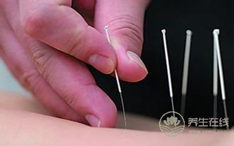 找準針灸減肥五大穴位 塑造纖細身姿-易網健康<a href=http://m.aoa7937.com/jkys/ target=_blank class=infotextkey>養(yǎng)生</a>網 找準針灸減肥五大穴位 塑造纖細身姿