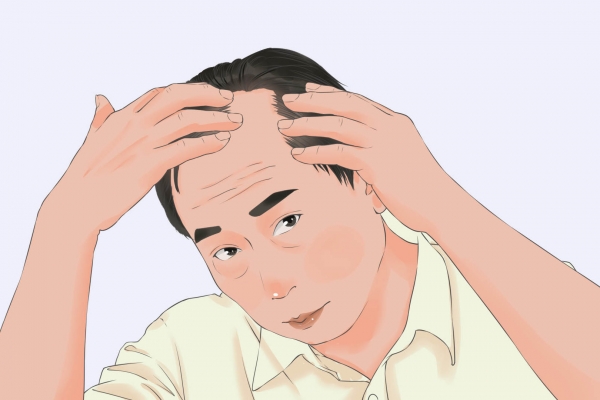 脫發(fā)是腎虛嗎