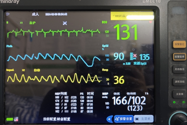 竇性心律不齊是指什么意思