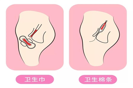衛生棉條解放女性自由 許多人卻擔心它會弄破處女膜？