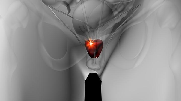 男性性功能障礙怎樣預(yù)防比較好？為什么心理因素會(huì)影響性功能？
