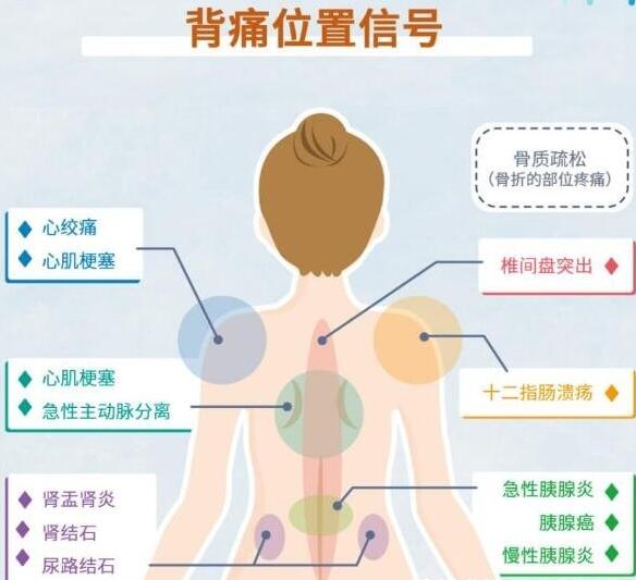 女性后背疼警惕四種病，腰部周圍痛小心婦科病(疼痛位置圖解)