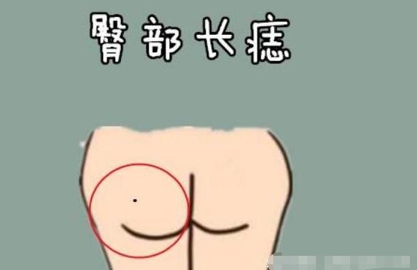 女人身上最好的16痣圖解大全，屁股有痣最富貴(位置與命運(yùn))