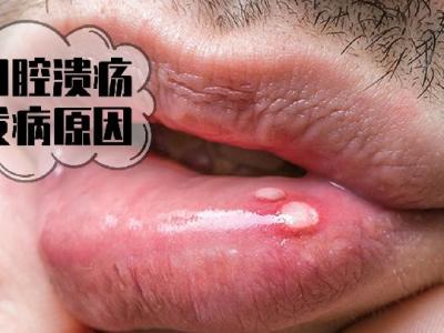 邊吃美食邊減肥，靠譜的秘訣在這里