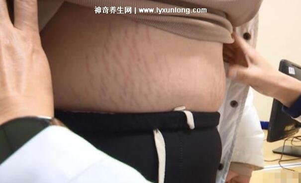 司美格魯肽注射減肥有副作用嗎多少錢，550元正常人打很危險