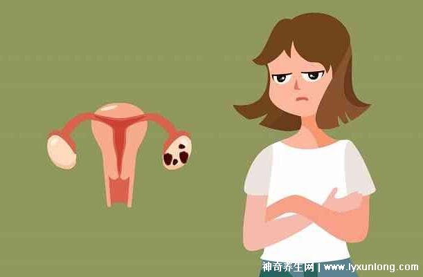 子宮肌瘤最怕三個運動，激烈的運動和夫妻生活導致肌瘤增大