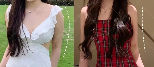 想吸脂后美美穿比基尼，這3大細(xì)節(jié)要注意