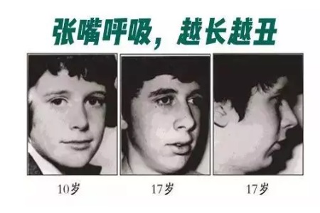 這些讓你變丑的習慣，再不改那可就沒救了！