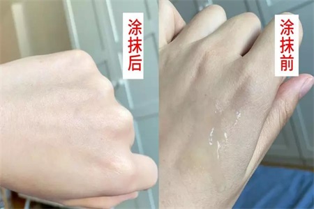敏感肌膚用什么護膚品？推薦這款護膚禮盒清爽過夏天