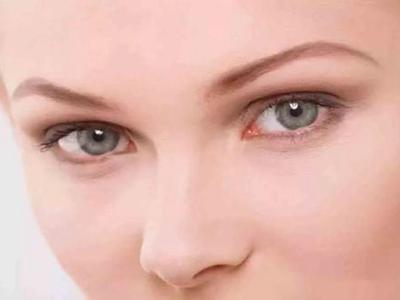 水腫、黑眼圈只是因為沒睡好？女性眼部問題潛藏的病癥