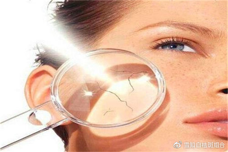 天然維生素的補充劑,生活中的必備佳品-易網健康養生網 天然維生素的補充劑,生活中的必備佳品