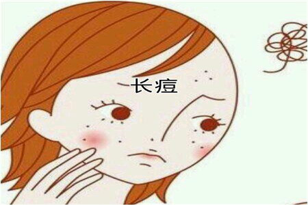 青春期女性長痘必非小事？可能要面臨的問題以及建議性護(hù)膚法