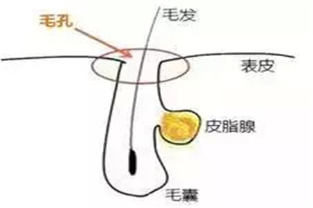 毛孔粗大如何清潔 改善膚質必備的幾個護膚小知識
