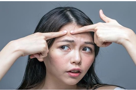 女生額頭長痘的原因，對癥下藥才能有干凈肌膚