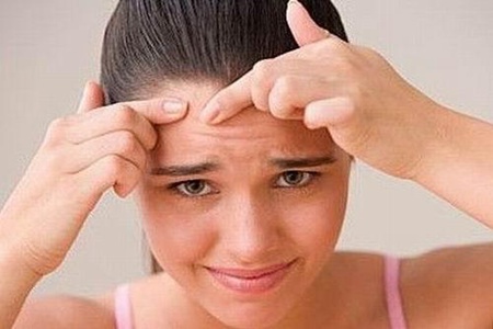 女生額頭長痘的原因，對癥下藥才能有干凈肌膚