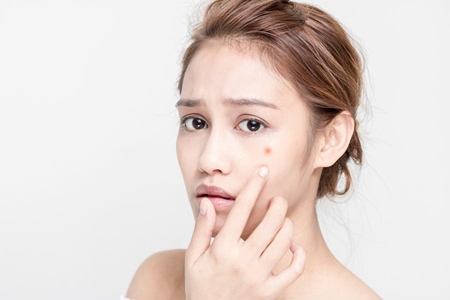 面部痤瘡如何治療，女性針對不同膚質(zhì)進(jìn)行治療最佳方法
