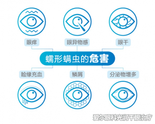 美妝達(dá)人全程直播干眼癥治療過(guò)程 光潤(rùn)干眼治療效果獲