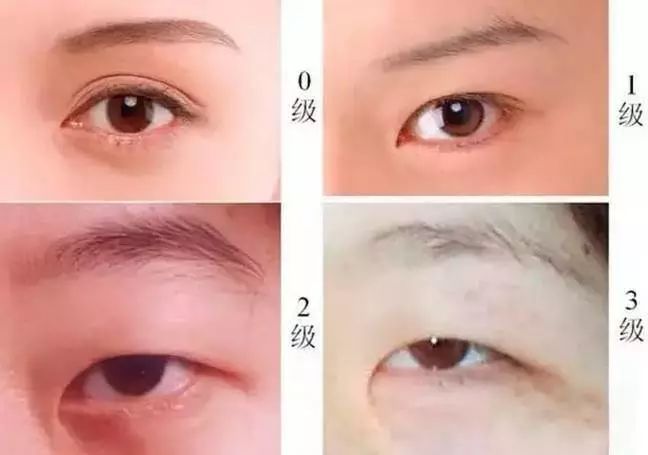 雙眼皮貼是在眼影之前還是之后？眼妝注意事項有哪些？