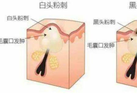 油性皮膚會有哪些肌膚問題 如何改善油性皮膚問題-易網<a href=http://m.aoa7937.com/ target=_blank class=infotextkey>健康養生</a>網 油性皮膚會有哪些肌膚問題 如何改善油性皮膚問題